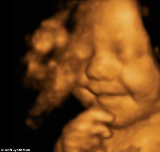 英国最幸福宝宝：从腹中胎儿到婴儿一直微笑