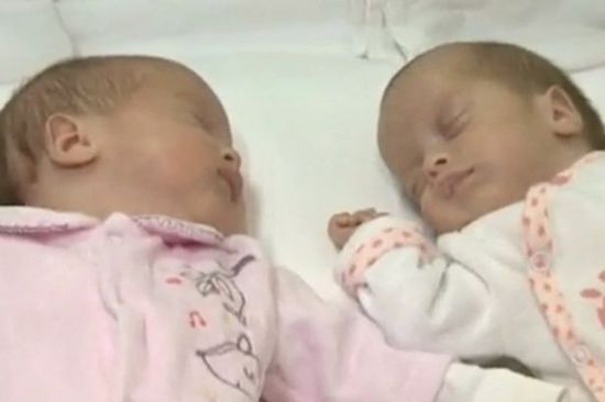 罗马尼亚双胞胎女婴出生日期相隔2个月