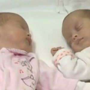 罗马尼亚双胞胎女婴出生日期相隔2个月