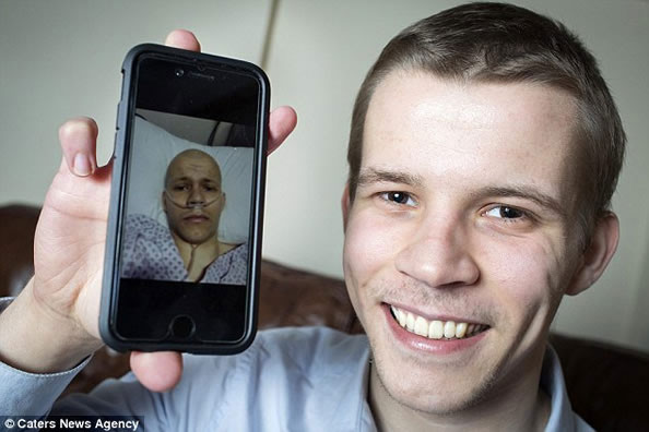 英国一男子用验孕棒检测出癌症 目前已痊愈