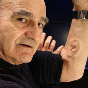 澳大利亚艺术家手臂上接种耳朵 可安装微型麦克风