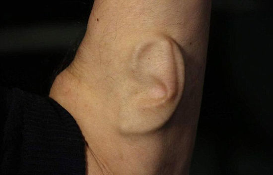 澳大利亚艺术家手臂上接种耳朵 可安装微型麦克风