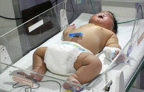 印度产妇15分钟顺产7公斤“奇迹宝宝” 体重创记录