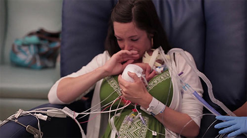 生命的奇迹：巴掌大的早产儿长成萌宝宝